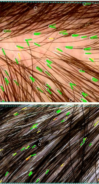 干细胞对头发的再生功能.png