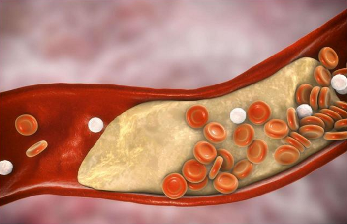 大豆肽降血脂是骗人的吗，喝大豆小分子肽降血脂的原因