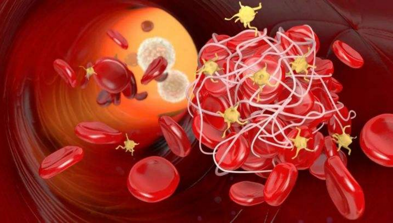 纳豆激酶与改善肠胃,纳豆激酶对改善血管供血的作用