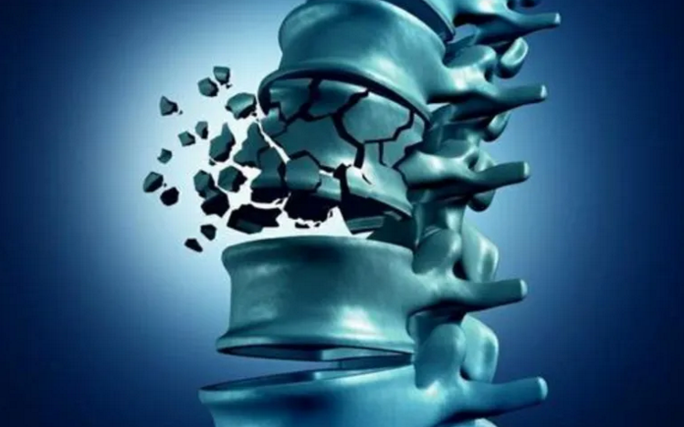胶原蛋白肽与增加骨密度和风湿痹症