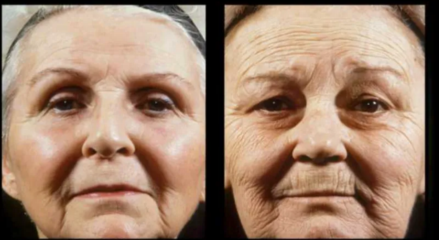 皮肤为什么会老化？皮肤抗衰老行动