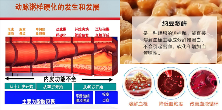 纳豆激酶抗动脉粥样硬化作用.png 纳豆激酶抗动脉粥样硬化作用.png